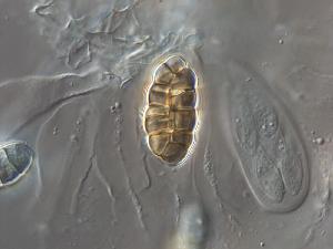 Coccodinium bartschii - Asci and ascospores