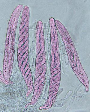 Photo of Cochliobolous heterostrophus C5
