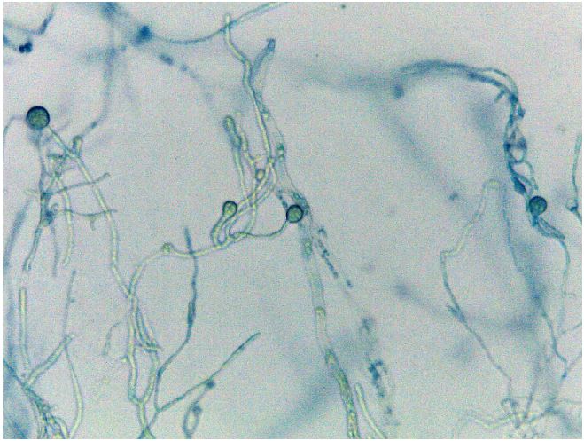 Micrograph of Dissophora sporangia (40X), possibly Dissophora ornata. Image by Gregory Bonito.