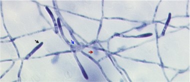 Figure 2. A light microscopic image of a colony of G. orontii at 5 dpi on A. thaliana leaf stained with Trypan Blue. The image shows the germinated spore (blue arrow), haustoria in epidermal cells (red arrow), mycelium spread over the leaf surface, and conidiophores containing new spores (black arrow). Magnification 200X.