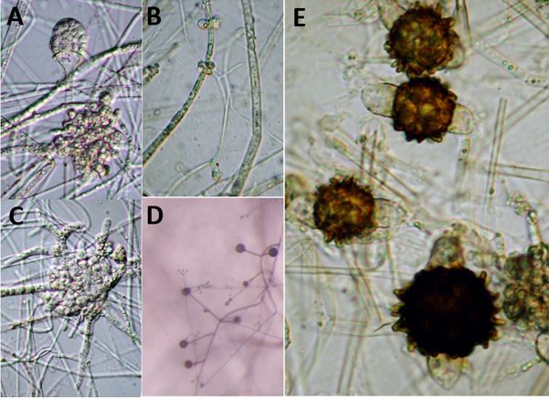 Fig. A. Lentamyces parricidus (Benny s116) sporangium and a large
multilobed gall where it is infecting the host Absidia. Fig. B.
Lentamyces parricidus (Benny s116) showing an early stage of gall
formation where it is infecting the host Absidia. Fig. C.
Lentamyces parricidus (Benny s116) showing a very large multilobed
gall where it is infecting the host Absidia. Fig. D. Lentamyces
parricidus (Benny s116) (fungus with the finer hyphae) parasitizing
a host fungus in the genus Absidia (fungus with thicker hyaphe).
Fig. E. Lentamyces parricidus (Benny s116) showing several
zygospores and the small hemi-sphaerical suspensors. Images by
Gerald Benny available on <a
href="http://zygomycetes.org/index.php?id=158">Zygomycetes.org
Lentamyces page.</a>