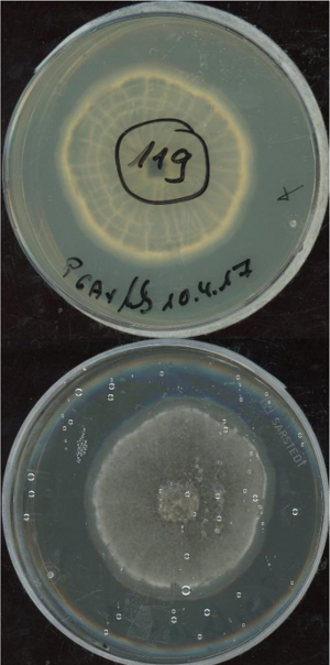 Leptodontidium orchidicola growing in the lab.