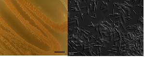 Meira miltonrushii culture on PDA (left) and cell morphology from yeast peptone glucose broth (right)