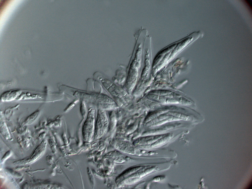 Asci with ascospores