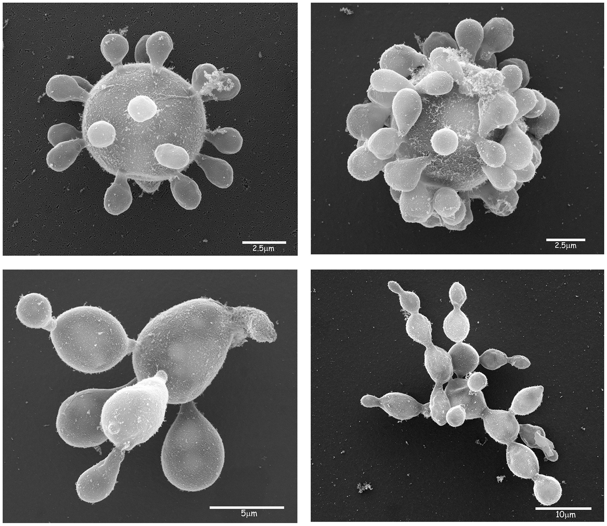 Paracoccidioides lutzii electron micrograph