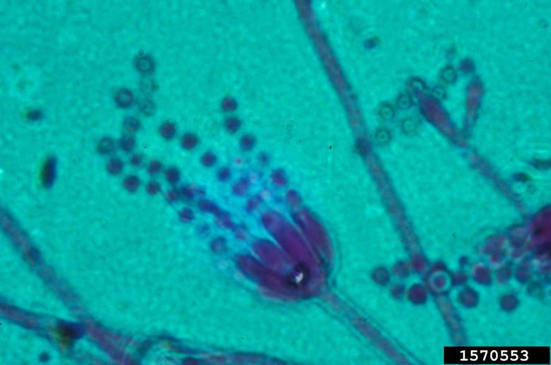 Photo of Penicillium citreonigrum cont 1189274 v1.0