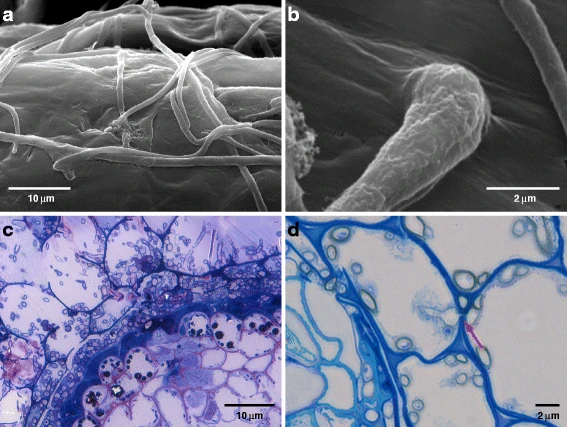 Photo of Phialocephala subalpina UAMH 11012