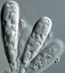 Asci with ascospores