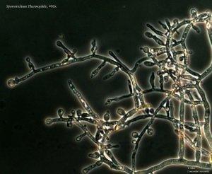 Photo of Sporotrichum thermophile.
