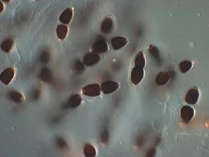 Tribi1 - Ascospores