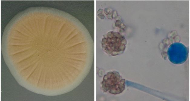 Colony of Umbelopsis sp. PMI123 growing on potato dextrose agar
(PDA; left) and under light microscopy (right). Umbelopsis is rich in lipids and
it produces terminal sporangia containing multiple sporangiospores.
Images by Alejandro Rojas.