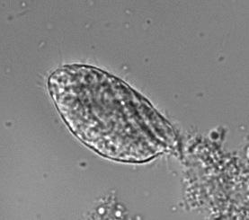 unknown ciliate