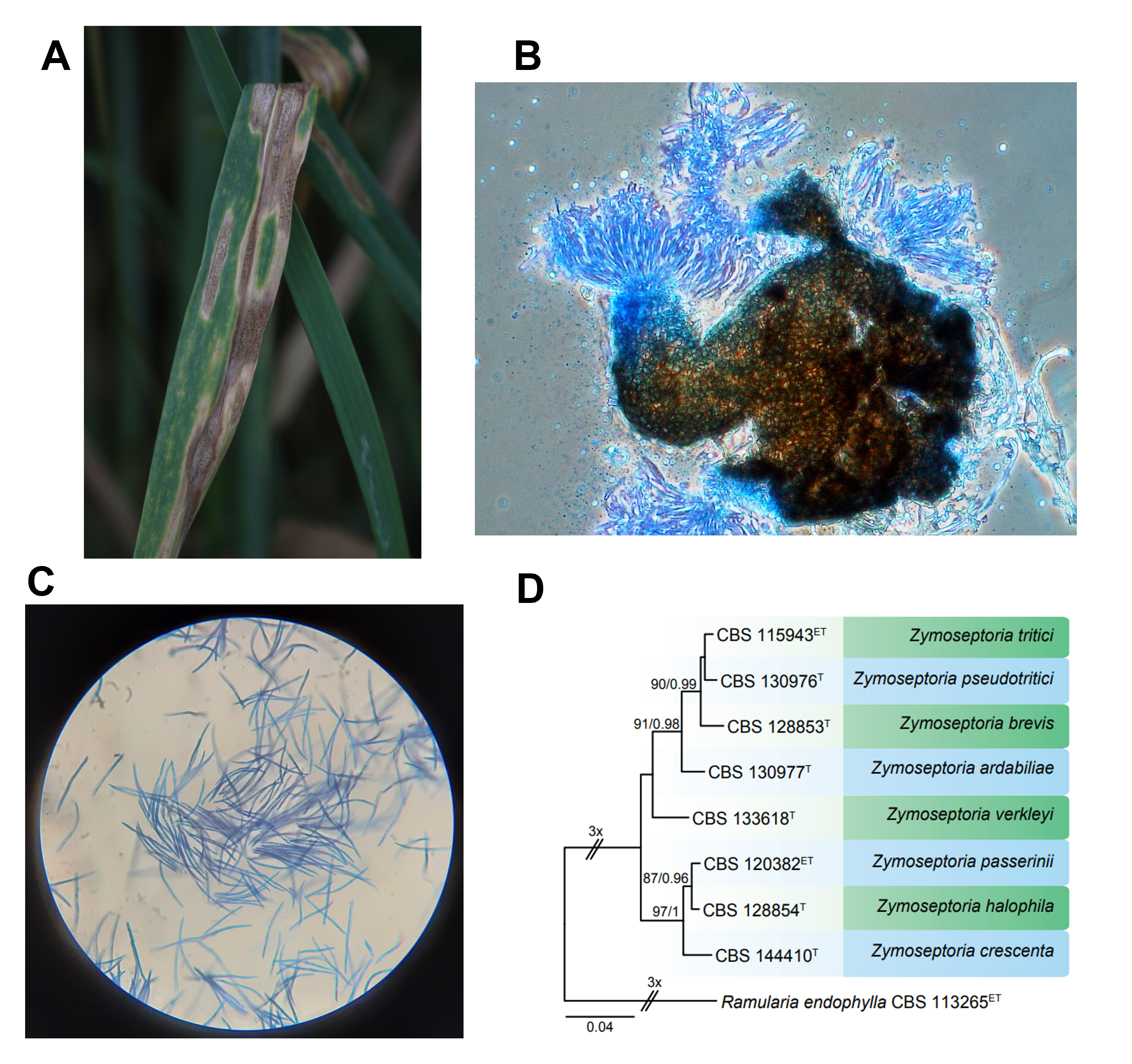 Photo of Zymoseptoria tritici IP0323 v2.0